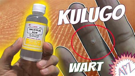 gamot sa kalonggo ng manok|Gamot Sa Kulugo: Paggamot Na Maaaring Gawin Sa Bahay.